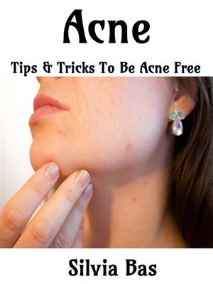 cover image of Acne